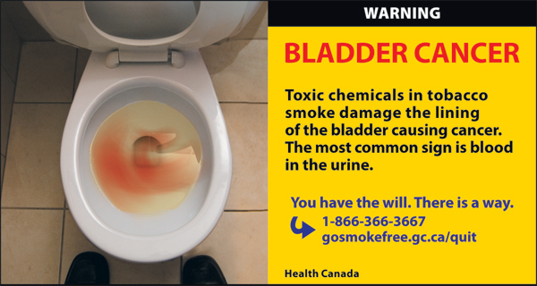 Canada 2012 Health Effects other - bladder cancer - cigars eng
